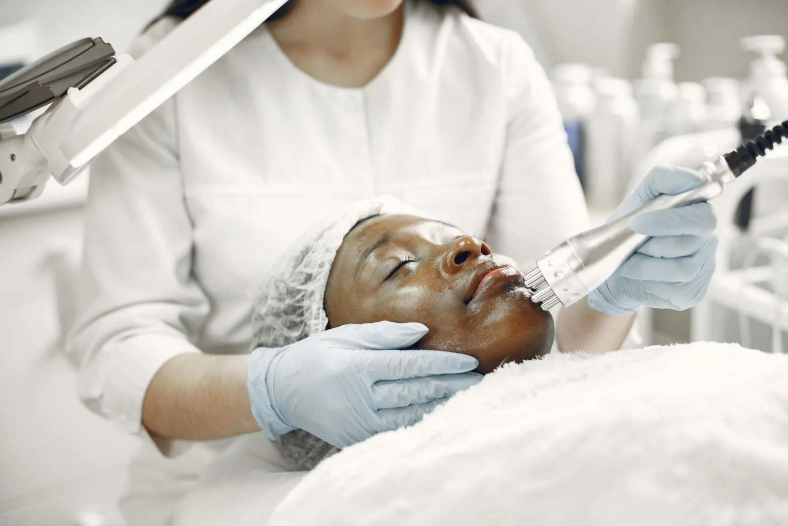 Microneedling
