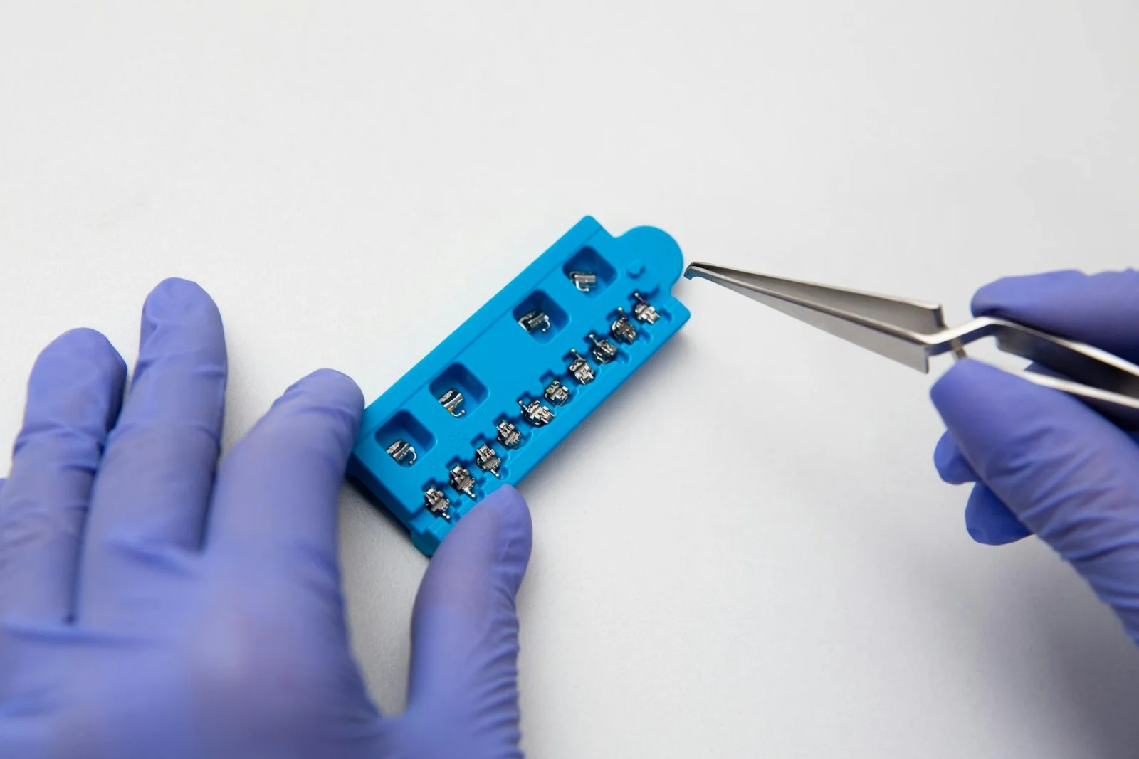 Behandeling met Myobrace