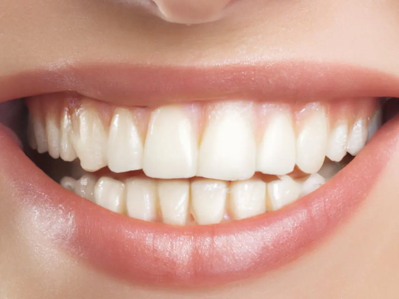 Behandeling met vaste apparatuur tips die u moet weten